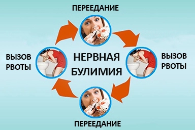 Лечение булимии в Безенчуке
